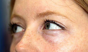 ҚОВОҚ ОСТИ ШИШИ НИМАДАН ДАРАК?